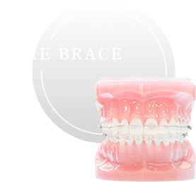 WIRE BRACE