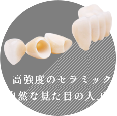 高強度のセラミック自然な見た目の人工歯 